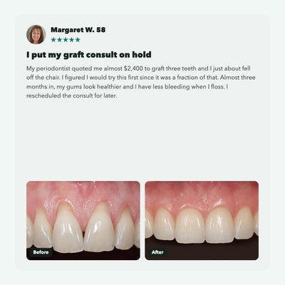 Liorva GumRevive: Collagen Gum & Enamel Powder