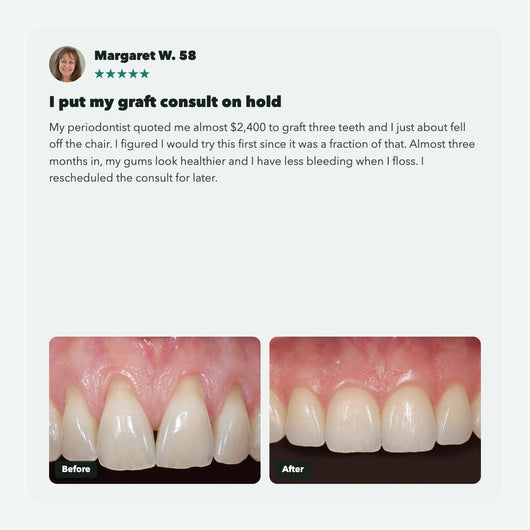 Liorva GumRevive: Collagen Gum & Enamel Powder