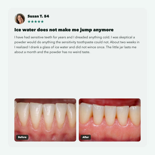 Liorva GumRevive: Collagen Gum & Enamel Powder
