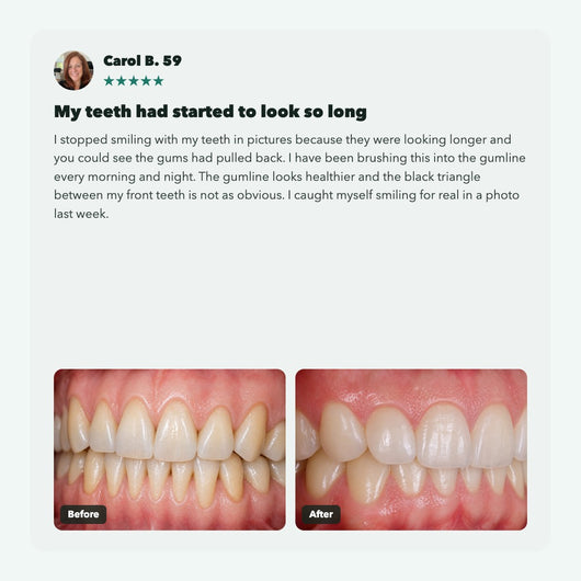 Liorva GumRevive: Collagen Gum & Enamel Powder